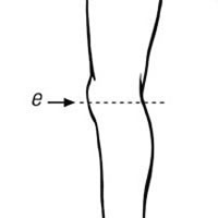 Orteza StabiloPro pentru genunchi, forma deschisa